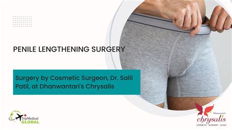 phalloplasty healed results|What is Phalloplasty: Overview, Benefits, and Expected Results.